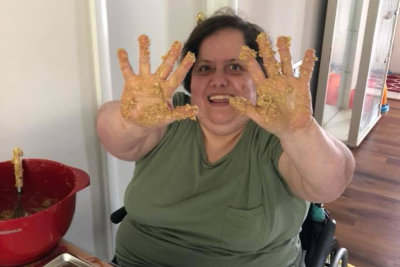 woman with disability showing her hands